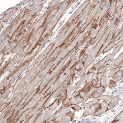 Invitrogen Laminin alpha-2 Monoclonal Antibody (CL3450) 100 &mu;L; Unconjugated:Antibodies,