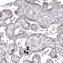 Invitrogen Laminin alpha-2 Monoclonal Antibody (CL3450) 100 &mu;L; Unconjugated:Antibodies,