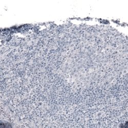 Invitrogen Laminin alpha-2 Monoclonal Antibody (CL3450) 100 &mu;L; Unconjugated:Antibodies,