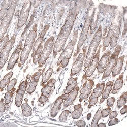 Invitrogen Laminin alpha-2 Monoclonal Antibody (CL3450) 100 &mu;L; Unconjugated:Antibodies,