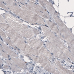 Invitrogen FCGRT Monoclonal Antibody (CL3638) 100 &mu;L; Unconjugated:Antibodies,