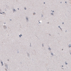 Invitrogen FCGRT Monoclonal Antibody (CL3640) 100 &mu;L; Unconjugated:Antibodies,
