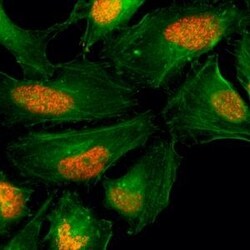 Invitrogen Histone H2A.X Recombinant Rabbit Monoclonal Antibody (RM214)