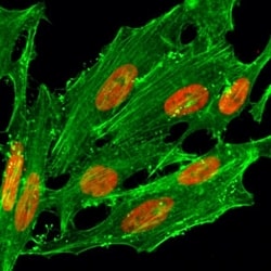 Invitrogen H2A.ZK7ac Recombinant Rabbit Monoclonal Antibody (RM222) 100