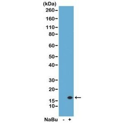 Invitrogen H3K14ac Recombinant Rabbit Monoclonal Antibody