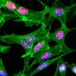 Invitrogen H3K23ac Recombinant Rabbit Monoclonal Antibody (RM169) 100 &mu;g;