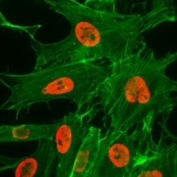 Invitrogen H3K27ac Recombinant Rabbit Monoclonal Antibody (RM172) 100 μg;