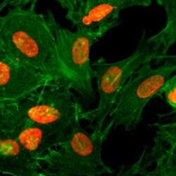 Invitrogen H3K36ac Recombinant Rabbit Monoclonal Antibody (RM154), ChIP-Verified