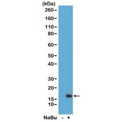 Invitrogen H3K36ac Recombinant Rabbit Monoclonal Antibody (RM154), ChIP-Verified