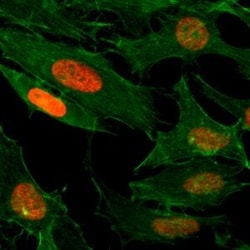 Invitrogen H3K4ac Recombinant Rabbit Monoclonal Antibody (RM149), ChIP-Verified