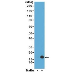 Invitrogen H3K4ac Recombinant Rabbit Monoclonal Antibody (RM149), ChIP-Verified