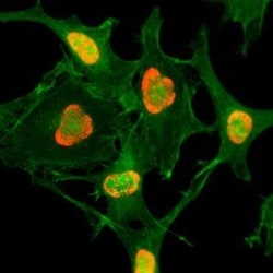 Invitrogen H3K79ac Recombinant Rabbit Monoclonal Antibody (RM156) 100 &mu;g;