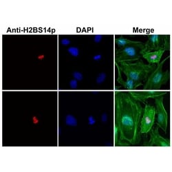 Invitrogen Phospho-Histone H2B (Ser14) Recombinant Rabbit Monoclonal Antibody