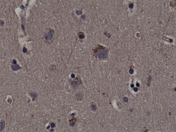 Invitrogen Phospho-RSK1 (Thr359, Ser363) Recombinant Rabbit Monoclonal