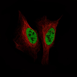 Invitrogen SMCHD1 Monoclonal Antibody (CL4270) 100 &mu;L; Unconjugated:Antibodies,