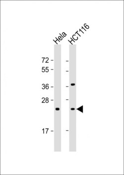 Invitrogen RAB8A Monoclonal Antibody (261CT1.3.1) 400 &mu;L; Unconjugated:Antibodies,