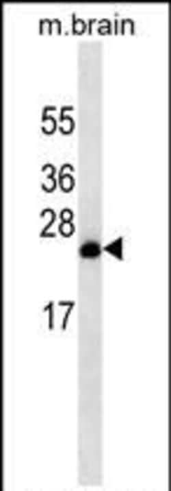 Invitrogen RAB8A Monoclonal Antibody (261CT1.3.1) 400 &mu;L; Unconjugated:Antibodies,
