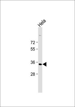 STRA8 Monoclonal Antibody (526CT11.1.5), Invitrogen 100 &mu;L; Unconjugated:Antibodies,