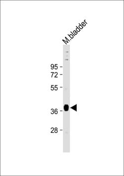 STRA8 Monoclonal Antibody (526CT11.1.5), Invitrogen 100 &mu;L; Unconjugated:Antibodies,