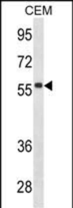 Invitrogen Human IgD Monoclonal Antibody (607CT8.4.4) 400 &mu;L; Unconjugated:Antibodies,