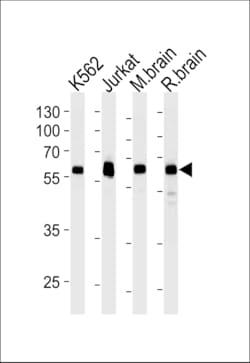 Invitrogen USP14 Monoclonal Antibody (889CT6.2.1) 400 &mu;L; Unconjugated:Antibodies,