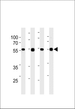 Invitrogen TPTE2 Monoclonal Antibody (978CT6.1.4) 100 &mu;L; Unconjugated:Antibodies,