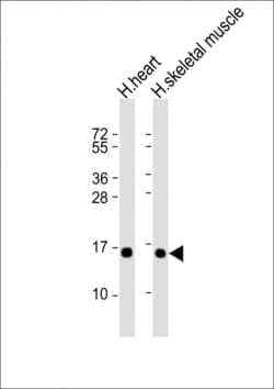 TUSC2 Monoclonal Antibody (1550CT388.74.12):Antibodies, Monoclonal