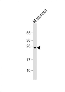 Invitrogen RAB27B Monoclonal Antibody (1596CT584.1.45) 200 &mu;L; Unconjugated:Antibodies,