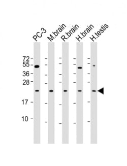 Invitrogen RAB18 Monoclonal Antibody (1573CT811.119.39) 200 &mu;L; Unconjugated:Antibodies,