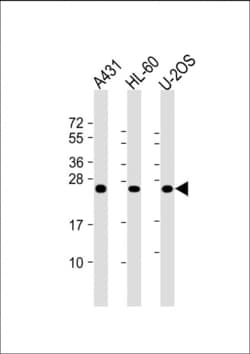 Invitrogen RAB5C Monoclonal Antibody (1616CT314.65.31) 200 &mu;L; Unconjugated:Antibodies,
