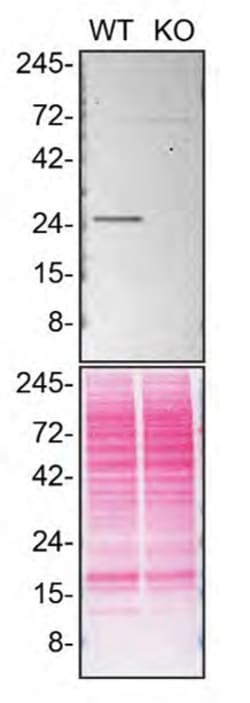 Invitrogen RAB5C Monoclonal Antibody (1616CT314.65.31) 200 &mu;L; Unconjugated:Antibodies,
