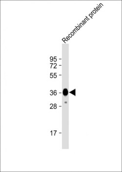 Invitrogen MYO18B Monoclonal Antibody (1683CT270.39.50) 200 &mu;L; Unconjugated:Antibodies,
