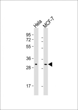 Invitrogen RAB20 Monoclonal Antibody (1694CT210.218.54) 200 &mu;L; Unconjugated:Antibodies,