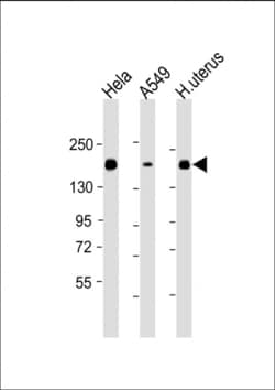 Invitrogen ITGA11 Monoclonal Antibody (1804CT459.14.18) 200 &mu;L; Unconjugated:Antibodies,