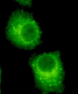 RAB2A Mouse anti-Human, Clone:, Invitrogen 100 &mu;L; Unconjugated:Antibodies,