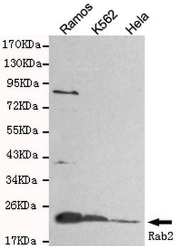 RAB2A Mouse anti-Human, Clone:, Invitrogen 100 &mu;L; Unconjugated:Antibodies,