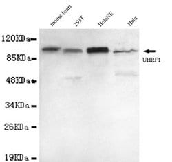 UHRF1 Mouse anti-Human, Mouse, Clone:, Invitrogen 100 &mu;L | Buy Online | Thermo Scientific | Fisher Scientific