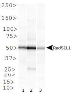 Invitrogen RAD51B Monoclonal Antibody (1 H3/13) 100 &mu;L | Buy Online | Invitrogen&trade; | Fisher Scientific