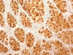 Invitrogen TCCR Monoclonal Antibody (34N4G11) 100 &mu;g; Unconjugated:Antibodies,