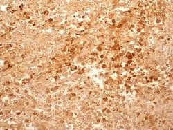 Invitrogen TCCR Monoclonal Antibody (34N4G11) 100 &mu;g; Unconjugated:Antibodies,