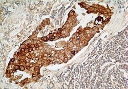 Invitrogen TCCR Monoclonal Antibody (34N4G11) 100 &mu;g; Unconjugated:Antibodies,