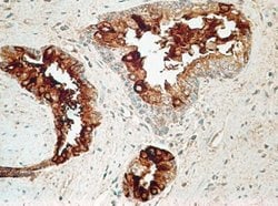 Invitrogen TCCR Monoclonal Antibody (34N4G11) 100 &mu;g; Unconjugated:Antibodies,