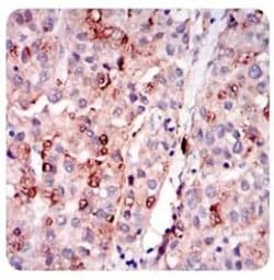 Invitrogen ADFP Monoclonal Antibody (2C5A3) 100 &mu;L; Unconjugated:Antibodies,