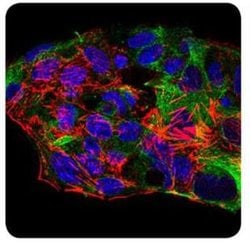 Invitrogen CTDSPL Monoclonal Antibody (6F9C5) 100 &mu;L; Unconjugated:Antibodies,