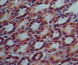 Invitrogen IL17RE Monoclonal Antibody (46N7E3) 100 &mu;g; Unconjugated:Antibodies,