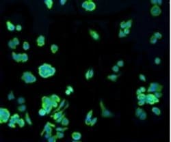 Invitrogen HSPA4 Recombinant Rabbit Monoclonal Antibody (3B3) 100 &mu;L;