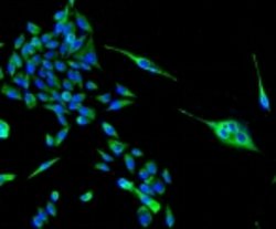 Invitrogen TSPO Recombinant Rabbit Monoclonal Antibody (4H2) 100 &mu;L;