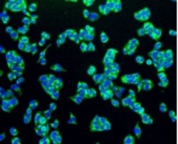 Invitrogen TSPO Recombinant Rabbit Monoclonal Antibody (4H2) 100 &mu;L;