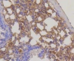 Invitrogen RPS3 Recombinant Rabbit Monoclonal Antibody (3D5) 100 μL;