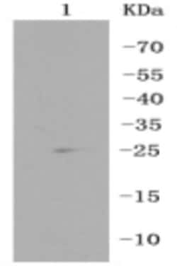 Invitrogen RPS3 Recombinant Rabbit Monoclonal Antibody (3D5) 100 μL;